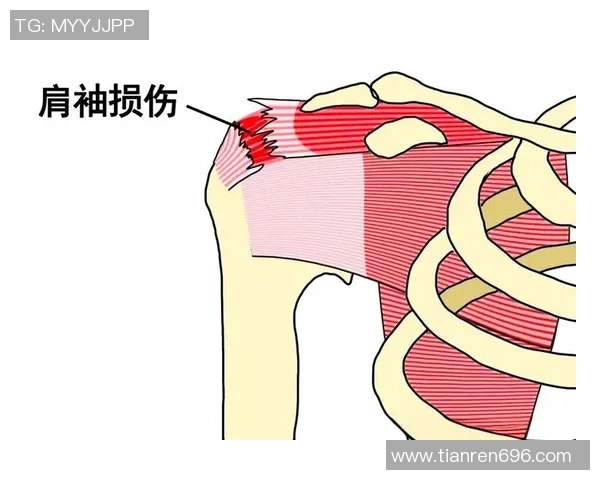 探索运动的无限可能：提升身体素质与心理健康的全面指南
